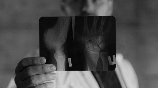 Strength Training for Bone Health: Preventing Osteoporosis After 50